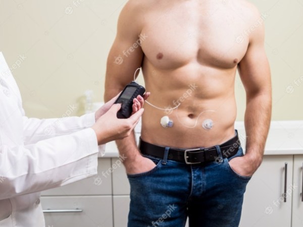 Bombas De Insulina 2 Escolha A&nbsp;Melhor